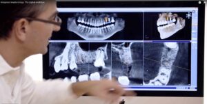 Video: Der digitale Workflow in der Implantologie