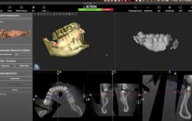 3D-Diagnostik in der zahnärztlichen Chirurgie – Session 1