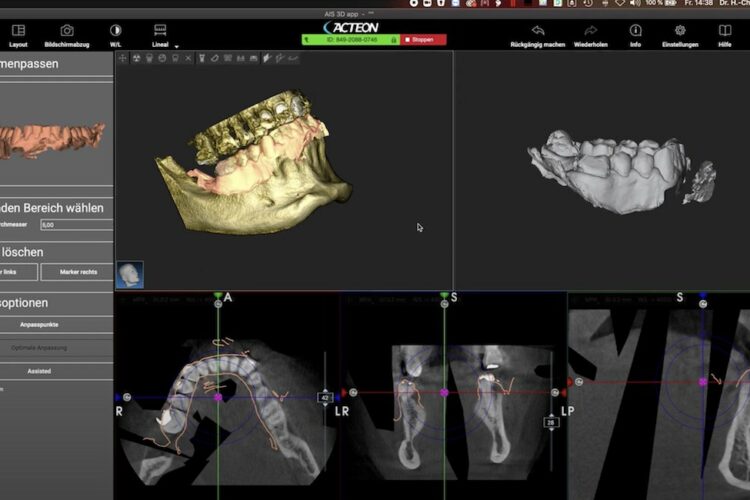 3D-Diagnostik in der zahnärztlichen Chirurgie – Session 1