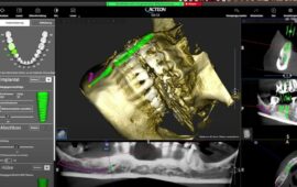 3D-Diagnostik in der zahnärztlichen Chirurgie – Session 2