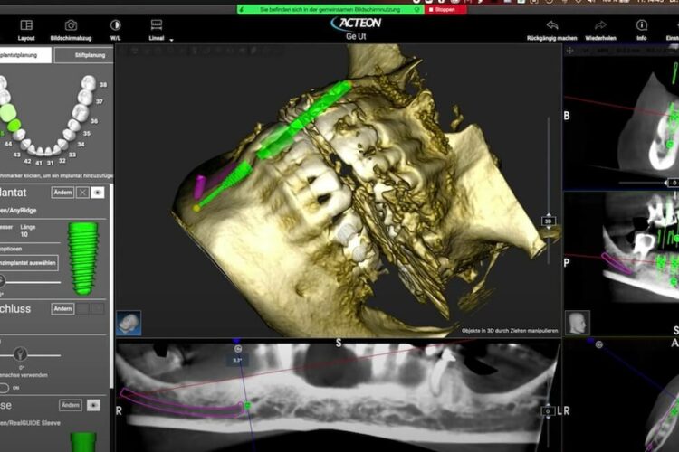 3D-Diagnostik in der zahnärztlichen Chirurgie – Session 2