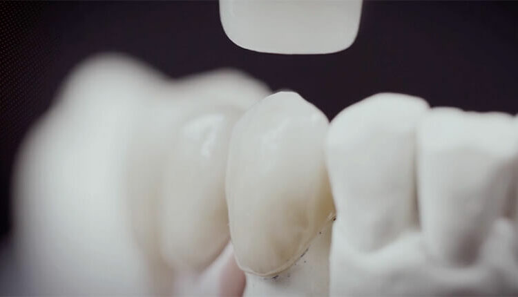 Wie sich dentale Spitzenleistung am besten realisieren lässt? Gemeinsam.