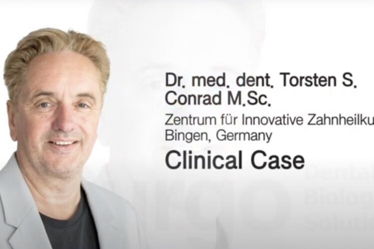 Dr. Torsten Conrad: Sofortbelastung unter Einsatz von Purgo THE Graft Collagen