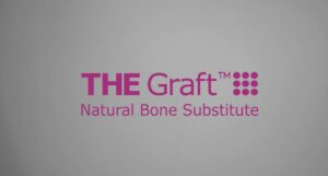 THE GraftTM Natural Bone Substitute