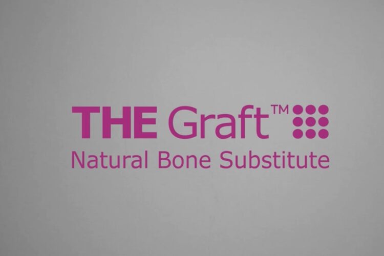 THE GraftTM Natural Bone Substitute