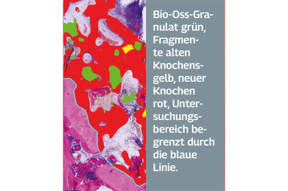... sind umgeben von gut durchblutetem Bindegewebe ohne Anzeichen einer Entzündung im Transplantationsbereich.
