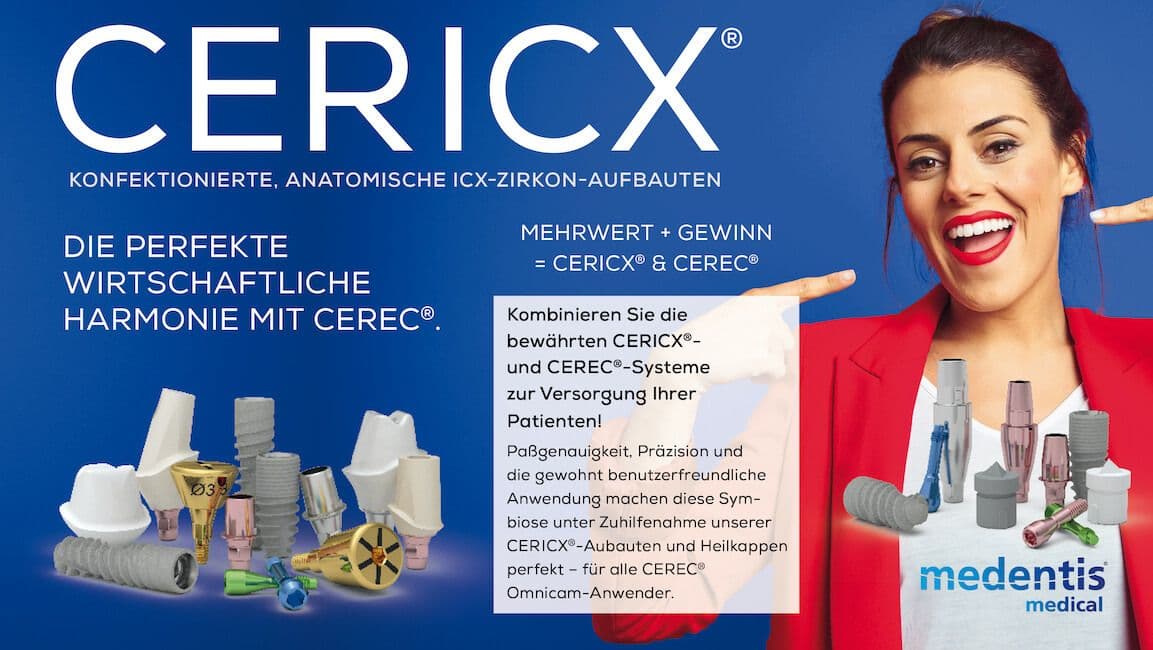 CERICX
