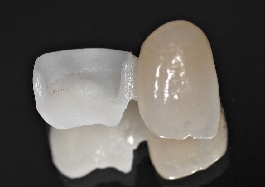 Cerec-Tag
