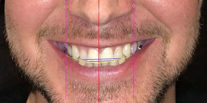 neu_PermaView Smile Design_2