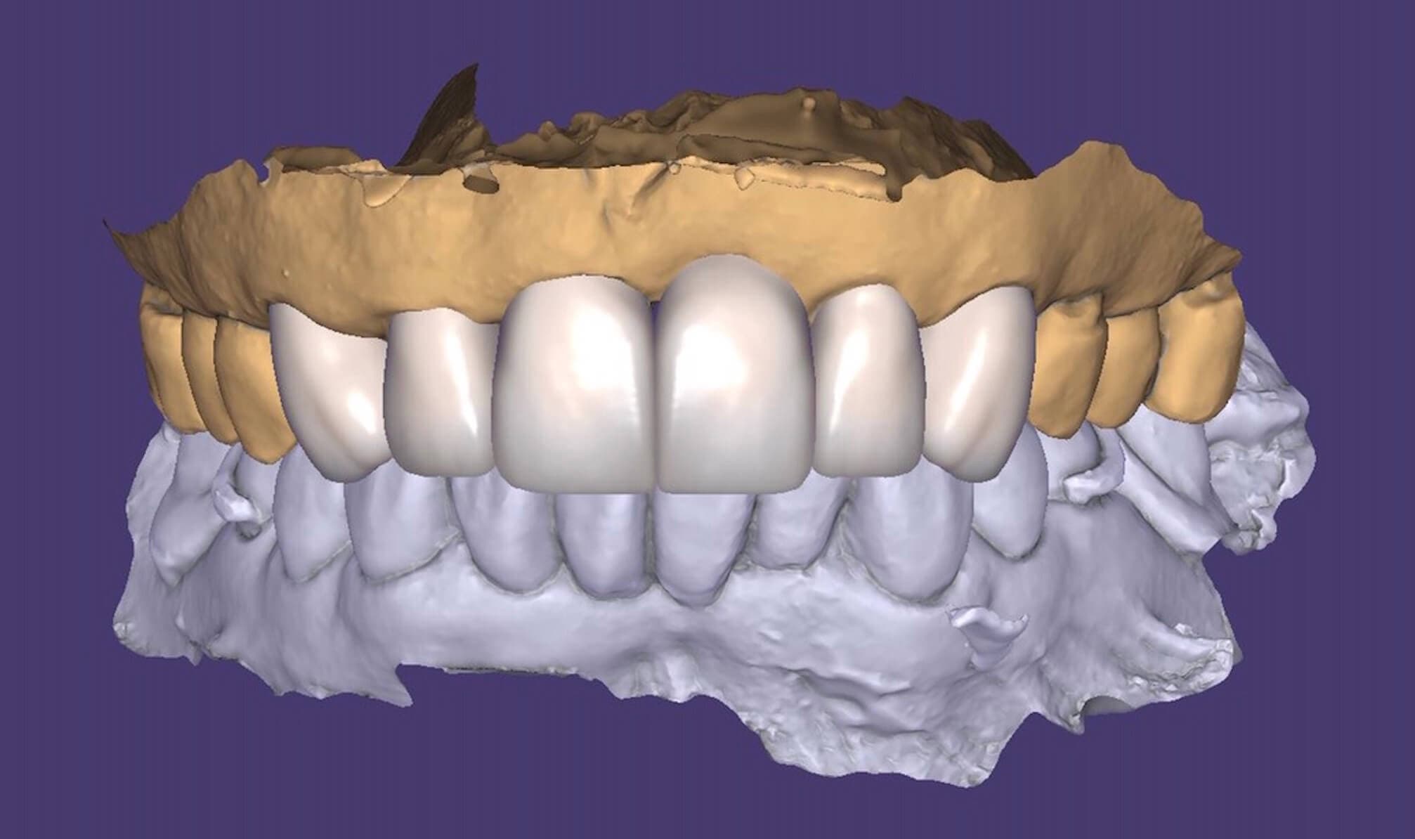 Permadental