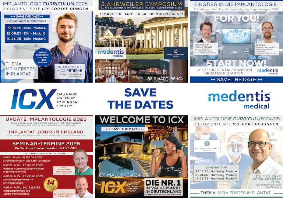 ICX