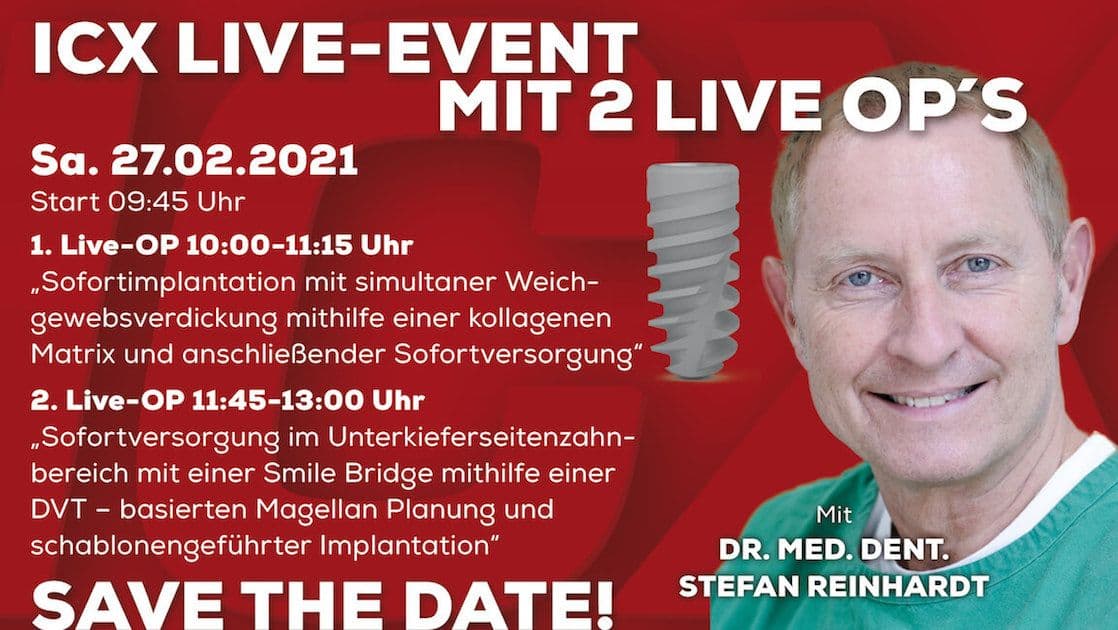 ICX Live-Event