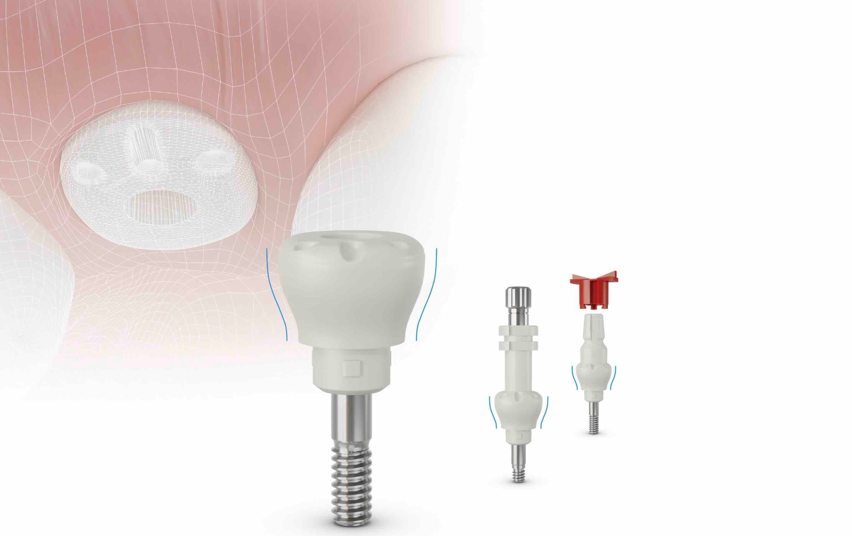 Gingividual-Concept-