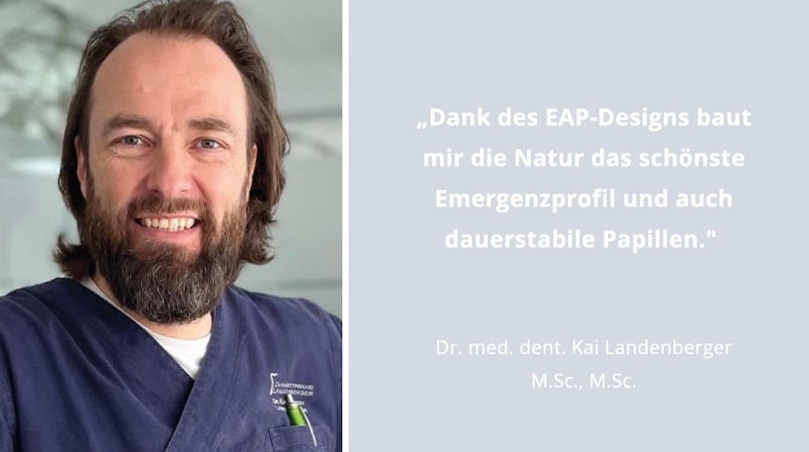 EAP