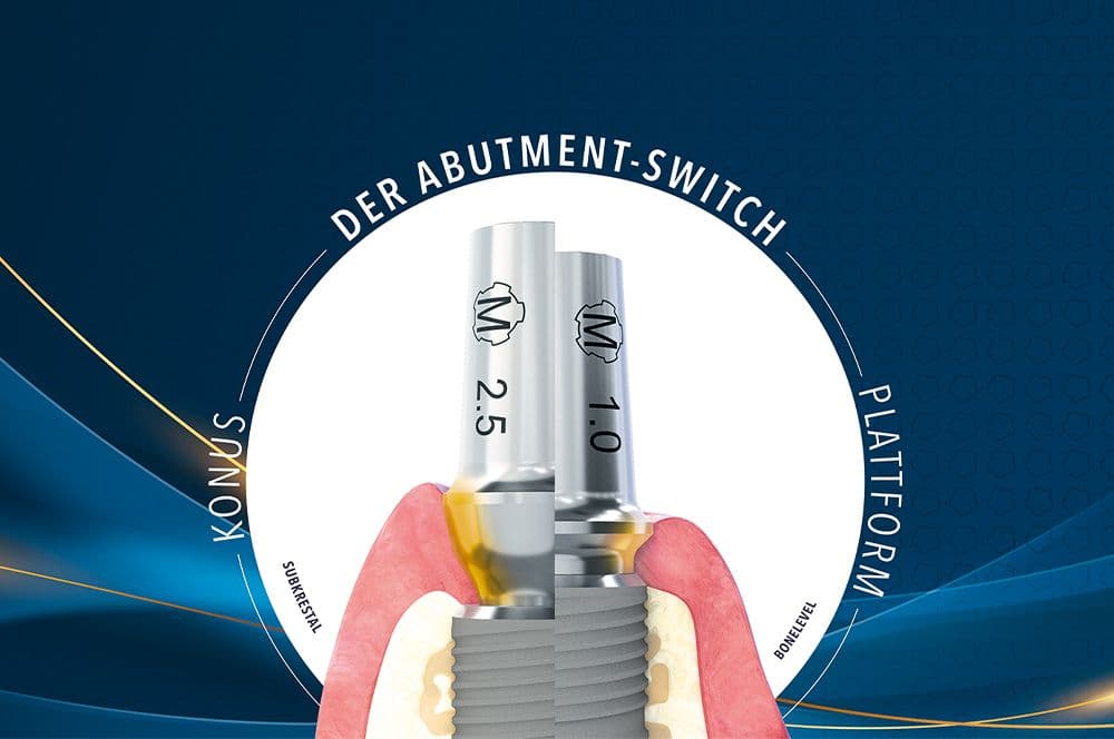 Grafik „Der Abutment-Switch" – Vergleich von Konus- und Plattform-Aufbau im Kieferquerschnitt"