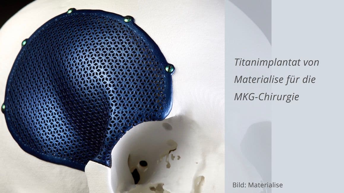 3D-Druck