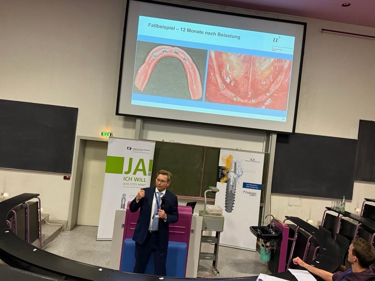 Prof. Dr. Dr. Norbert Enkling war ursächlich absolut kein Freund der Mini- Implantate und untersuchte sie an seinen Lehrstühlen in Bern und Bonn daher intensiv auf alle Fragen, die er sich selber zu Design und Stabilität gestellt hatte. Overdentures auf 4 Mini- Implantaten wie dem Cito Mini von Dentaurum sind für ihn heute im zahnlosen und schwer atrophen Unterkiefer eine sichere Therapieoption.