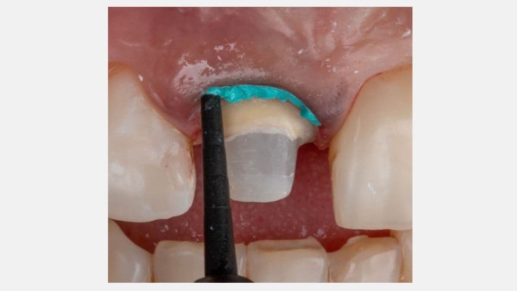 RetractionPaste