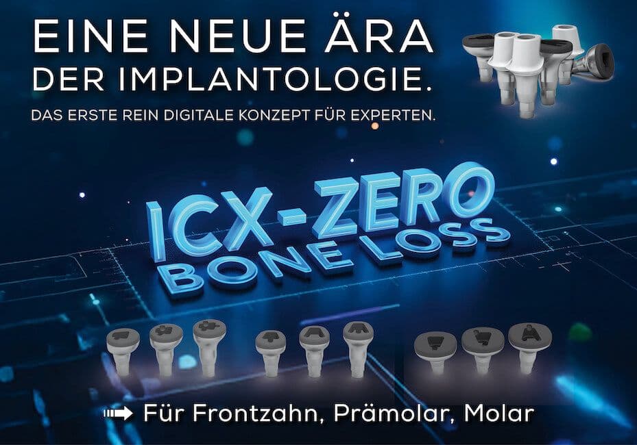 ICX-Zero Bone Loss