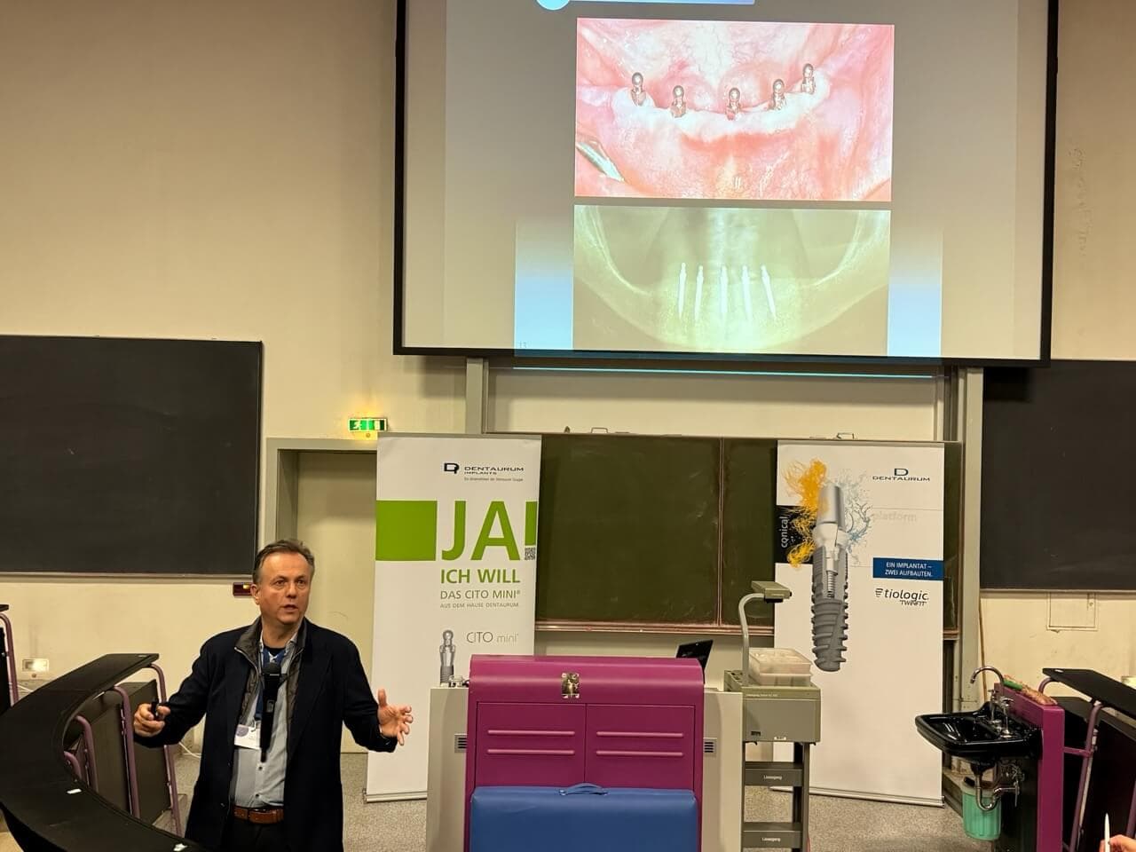 Die Versorgung mit Mini- Implantaten , definiert als Implantate < 2.7 Durchmesser, ist Prof. Dr. Friedhelm Heinemann ein “echtes Herzensthema”: Die sehr zuverlässige und inzwischen auch wissenschaftlich fundiert belegte Versorgung ist eine valide Erweiterung des implantologischen Spektrums und schafft speziell bei betagten oder wenig belastbaren Patienten mit stark atrophen Kiefern eine enorm verbesserte Lebensqualität und hohe Zufriedenheit . “Transgingival arbeite ich dabei nie ohne 3D-Diagnostik”.