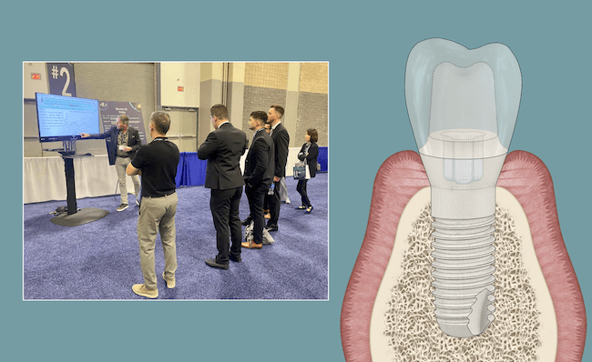 Periimplantitis