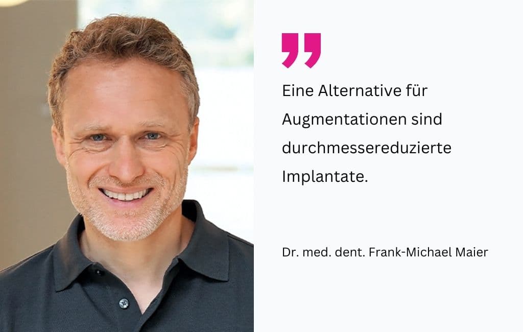 Augmentationen