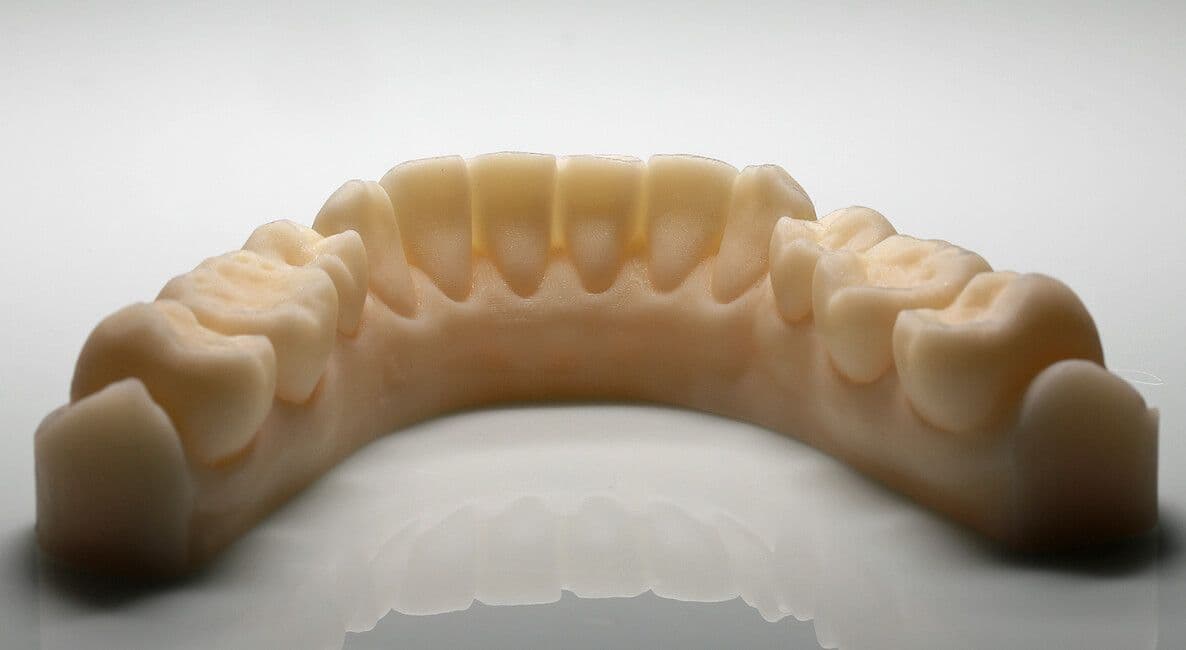 Cerec-Tag
