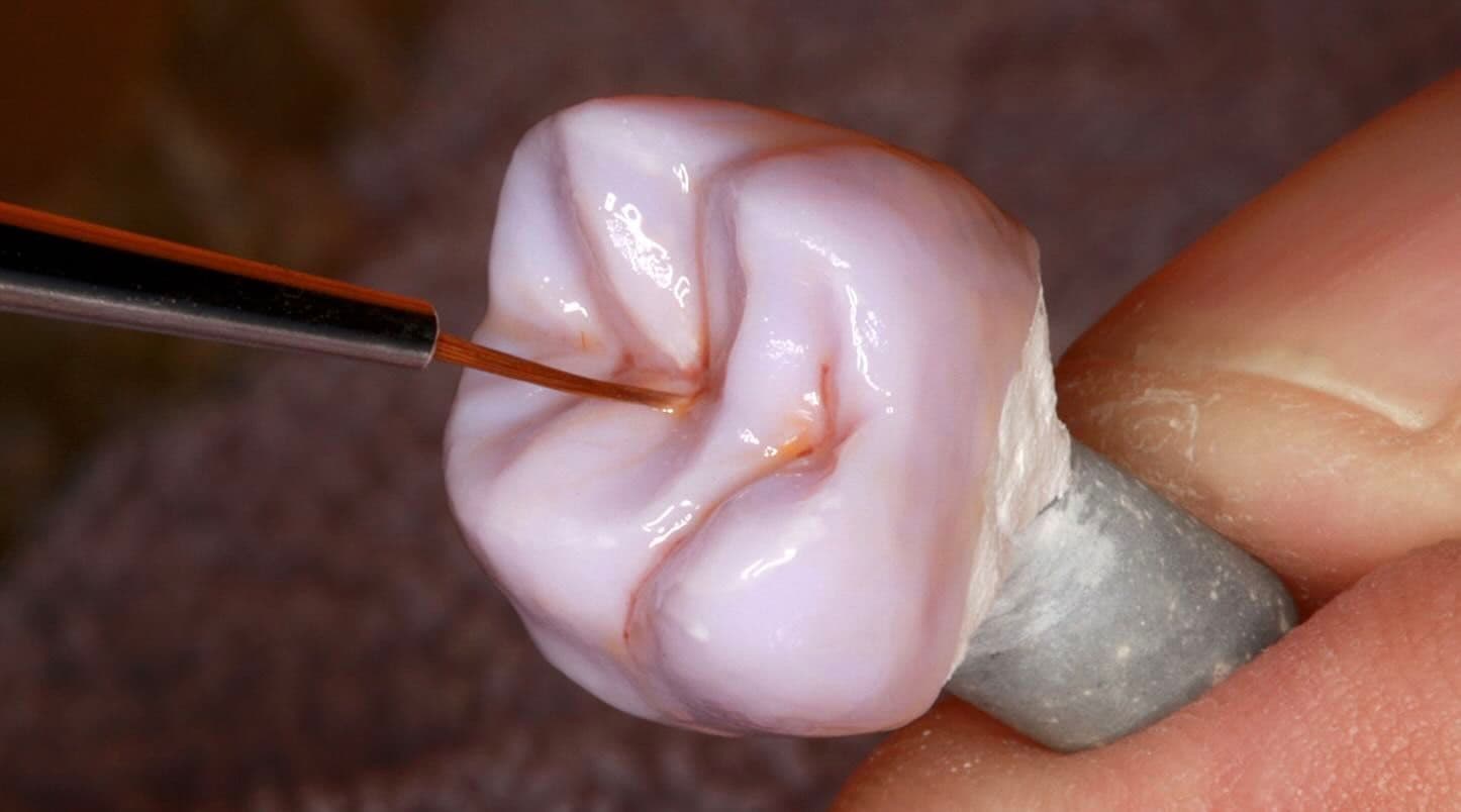 Nahaufnahme einer keramischen Zahnrestauration (Molar) auf einem Stumpfmodell, die mit einem feinen Pinsel und brauner Malfarbe individuell charakterisiert wird; das Präparat wird zwischen zwei Fingern gehalten.