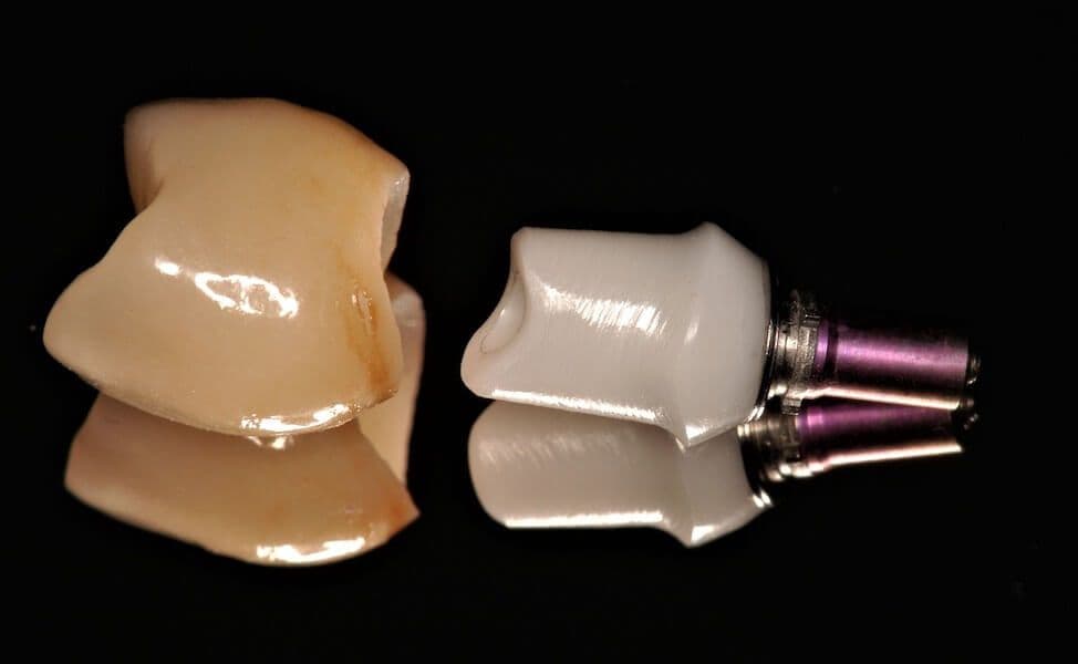 Cerec-Tag