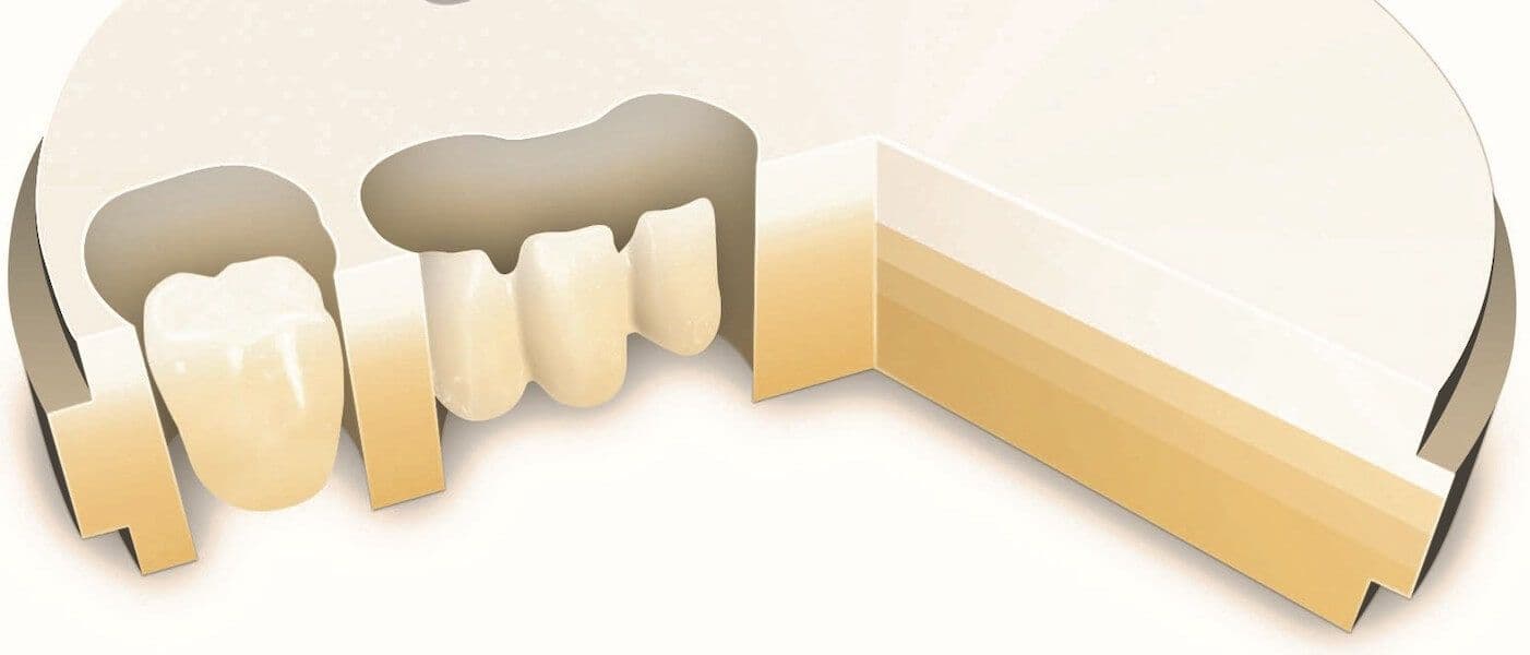 Cerec-Tag