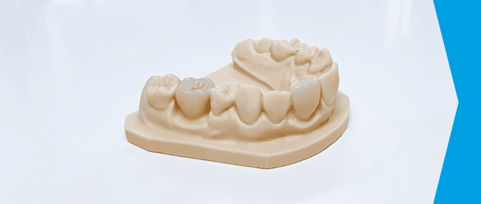 isar smile crown, isar dental