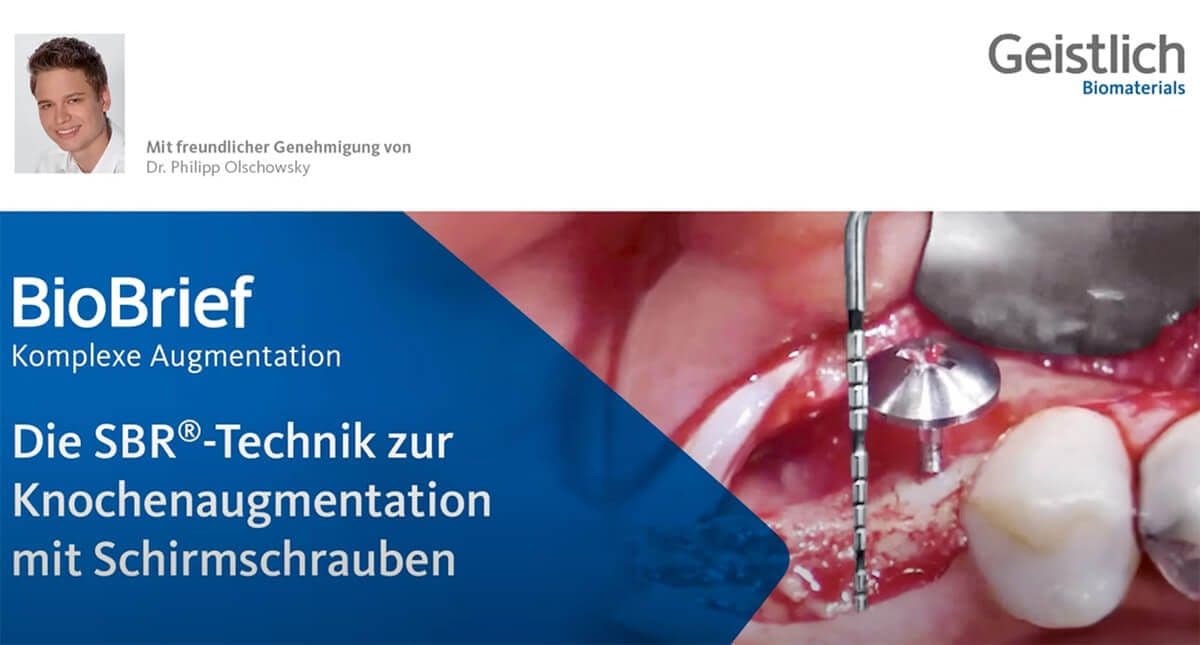 Stabilized Bone Regeneration