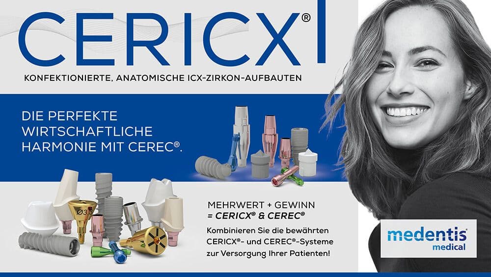 CERICX-und-Cerec