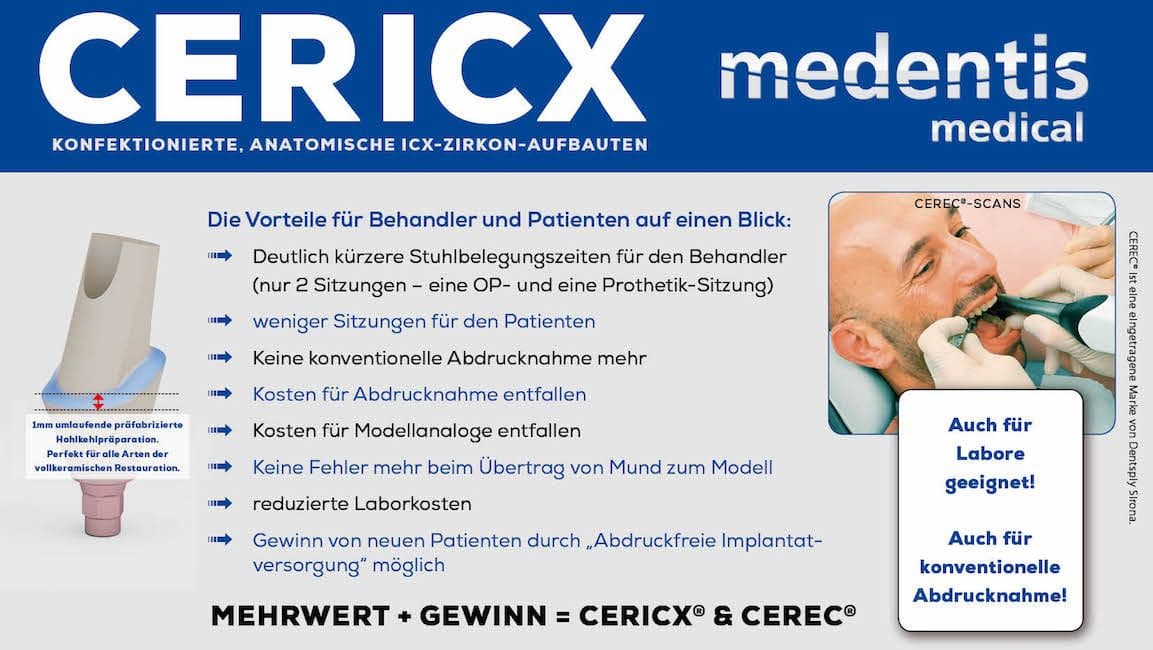 CERICX