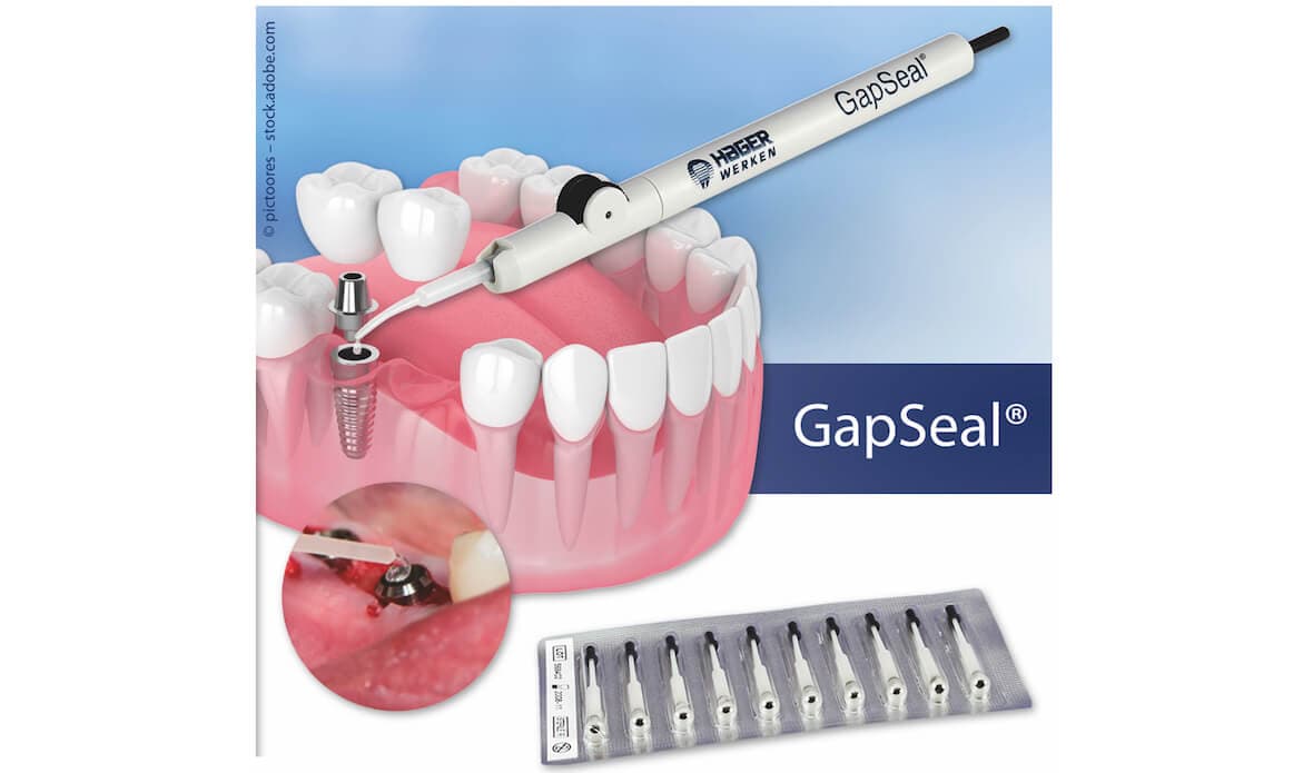 GapSeal