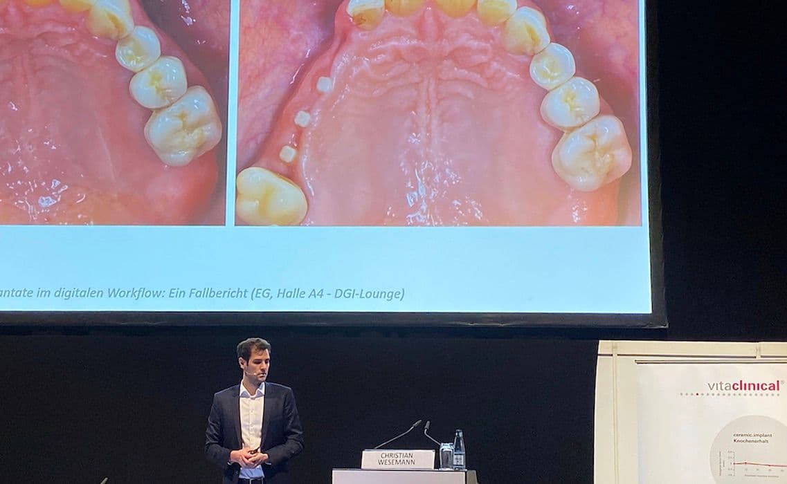keramische Implantate