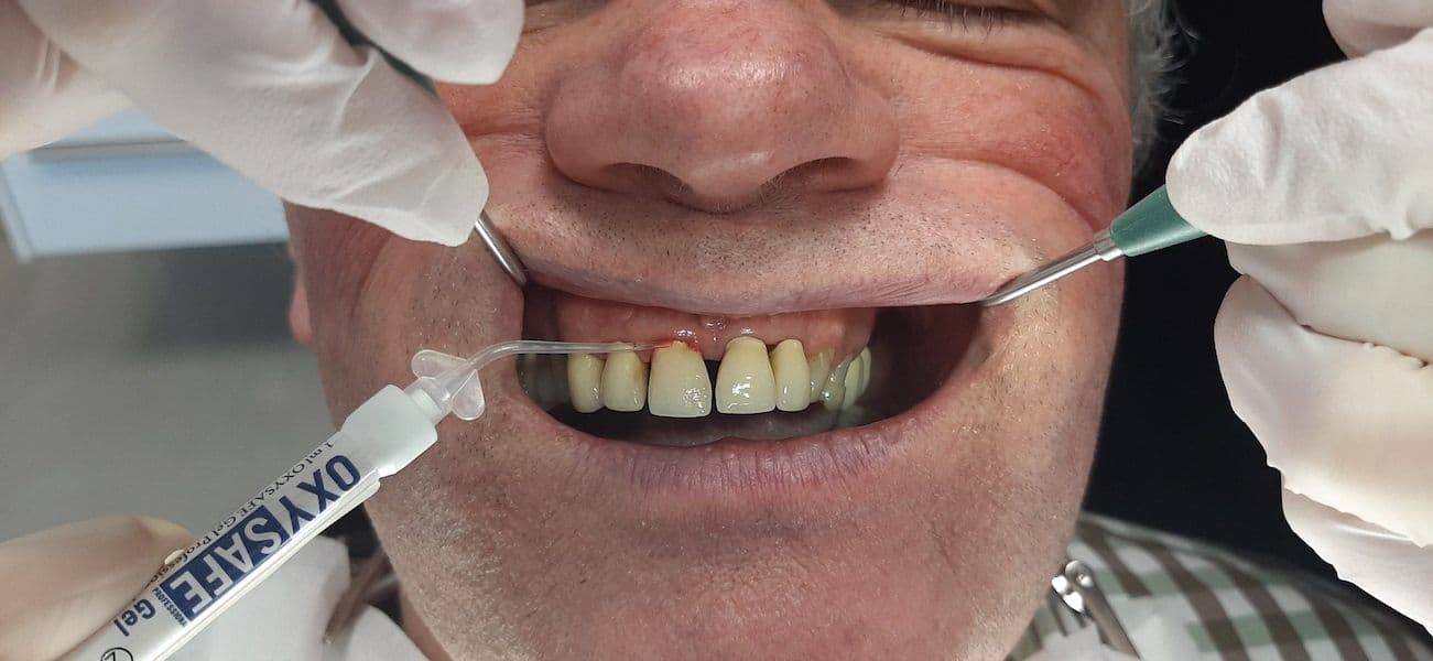 Oxysafe Gel