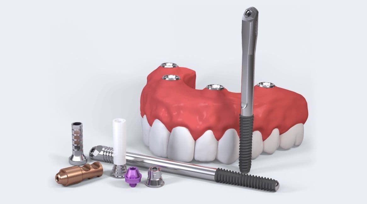 Zygoma Implantate