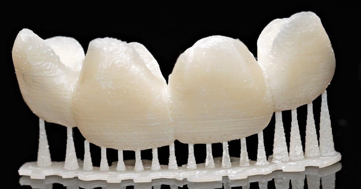 Cerec-Tag