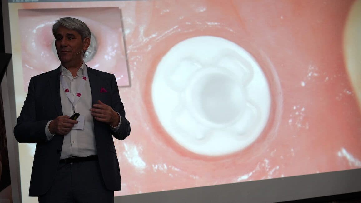 Keramikimplantate