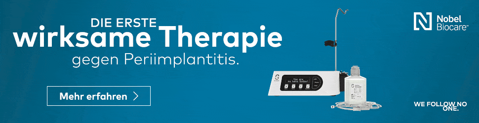 NB-pip-Banner-Large-Leaderboard-1940x500-GalvoSurge