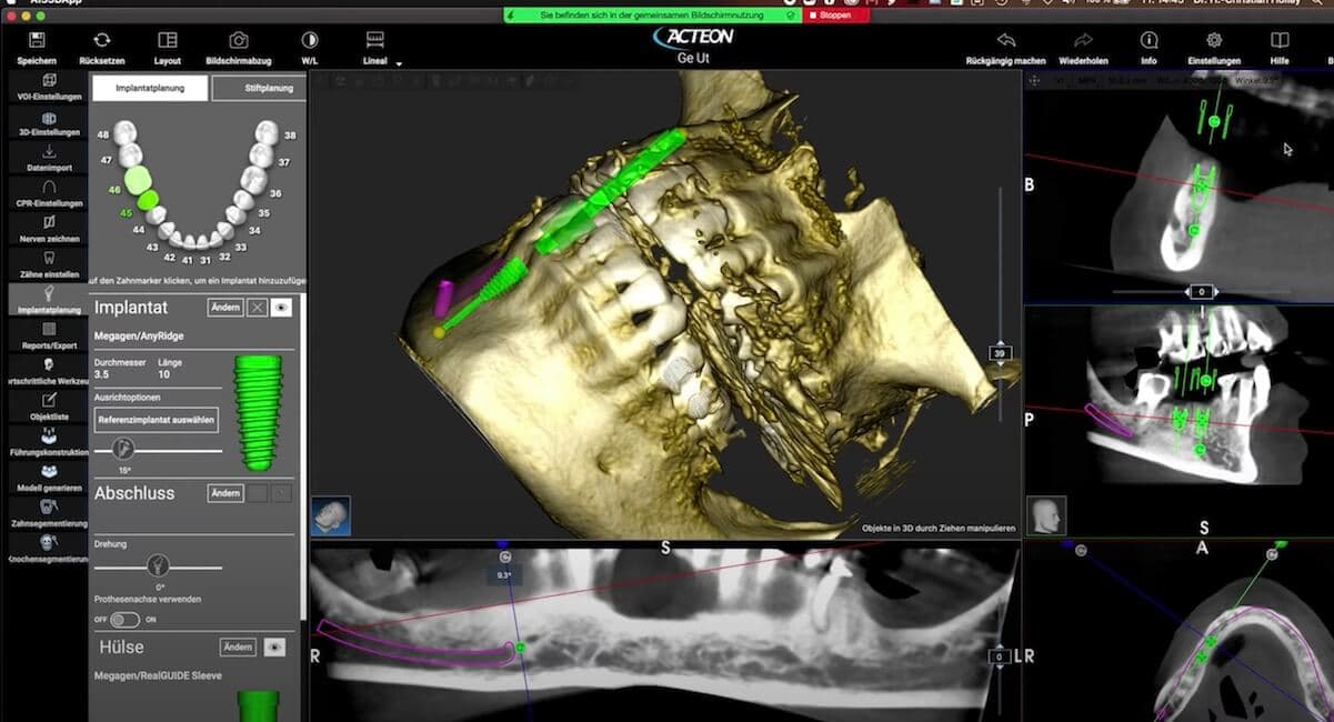 3D-Diagnostik