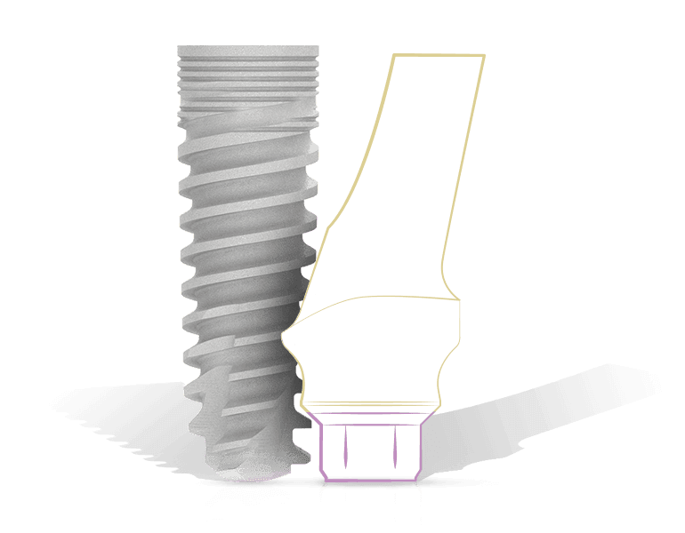 MIS-SEVEN-Gewindedesign