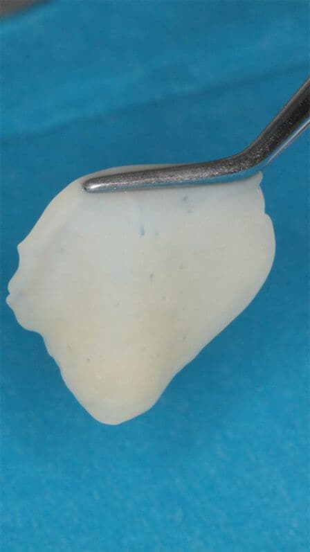 PRGF Membran