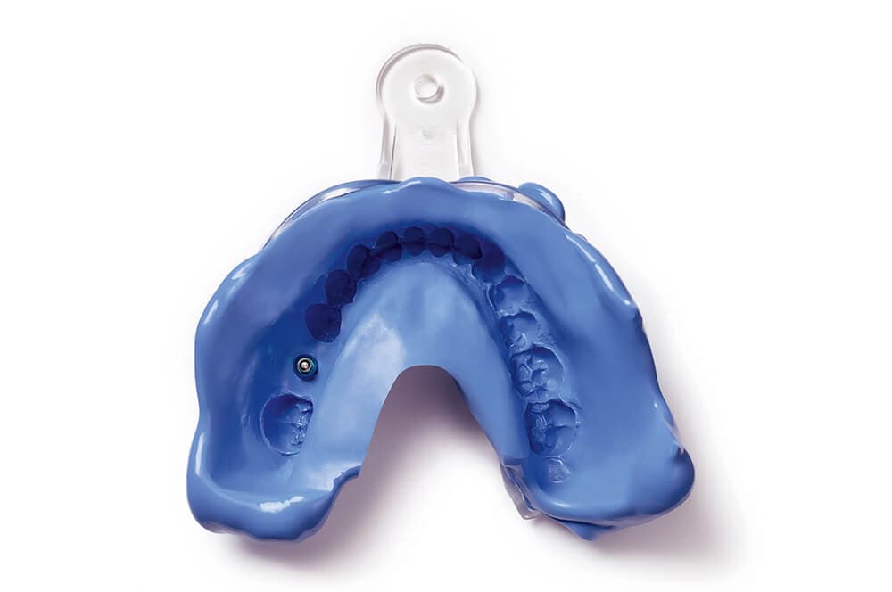 Hydrorise Implant
