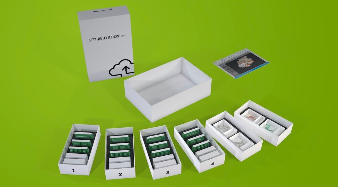 Implantatplanung