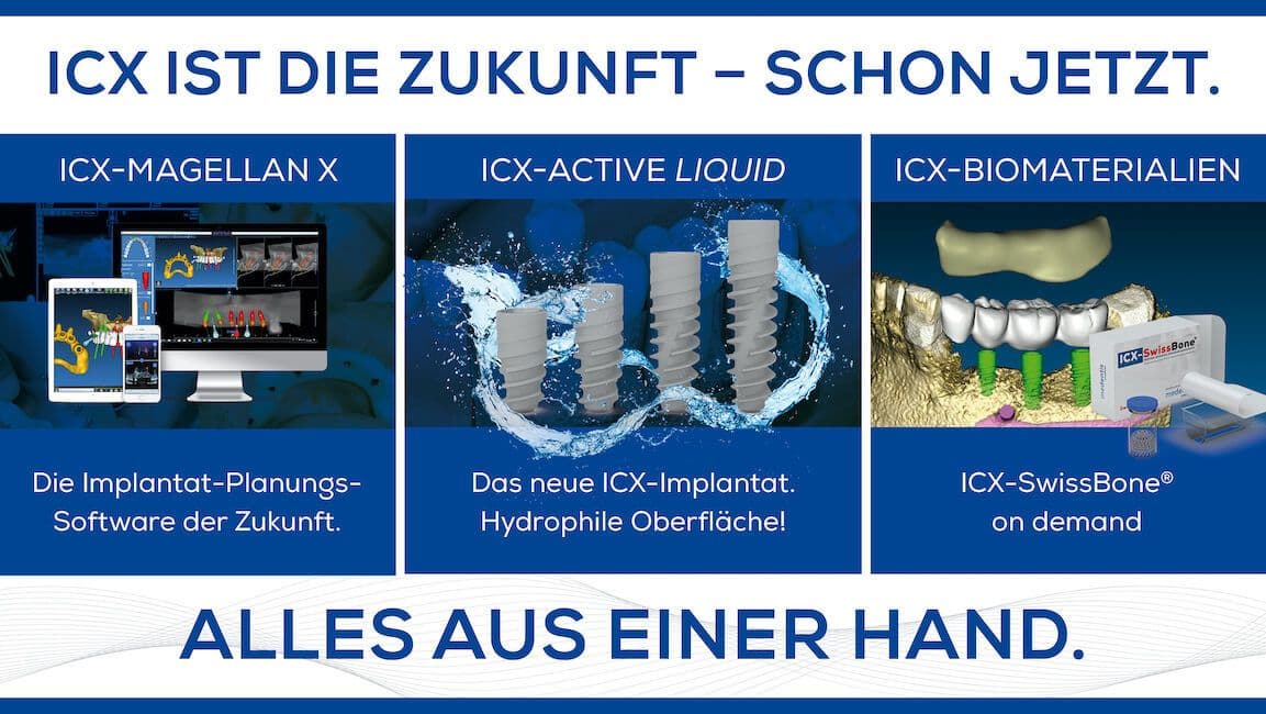 ICX