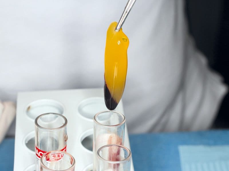 Platelet-Rich-Fibrin