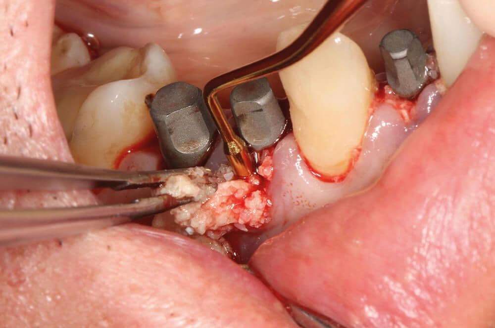 Tooth Transformer