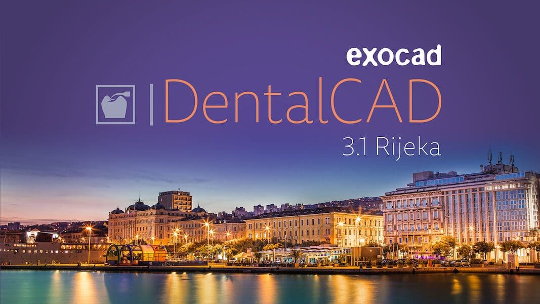 exocad_DentalCAD_3_1_Rijeka